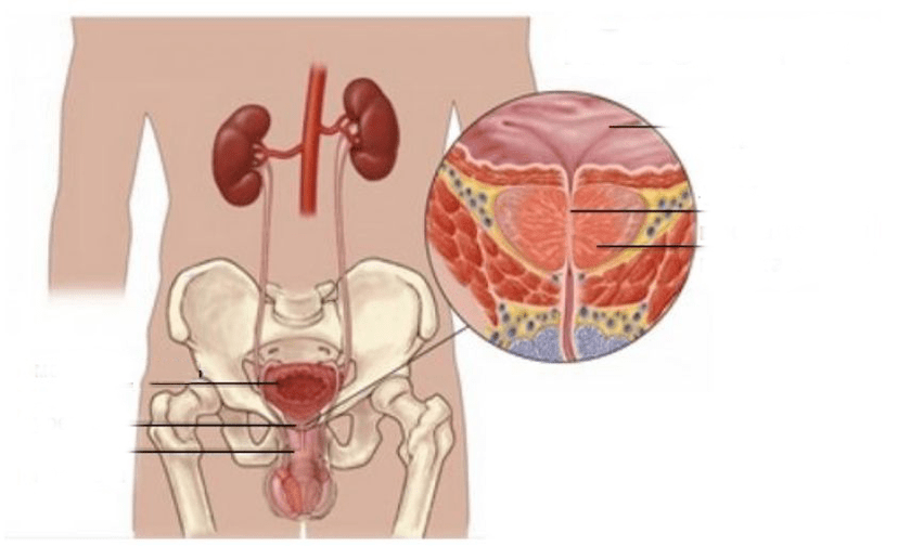 prosztatagyulladás férfiaknál